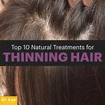 What Helps Thinning Hair on Top of Women's Head?