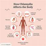 What If I Had Chlamydia for a Year?