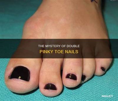 What Is a Double Pinky Toenail?