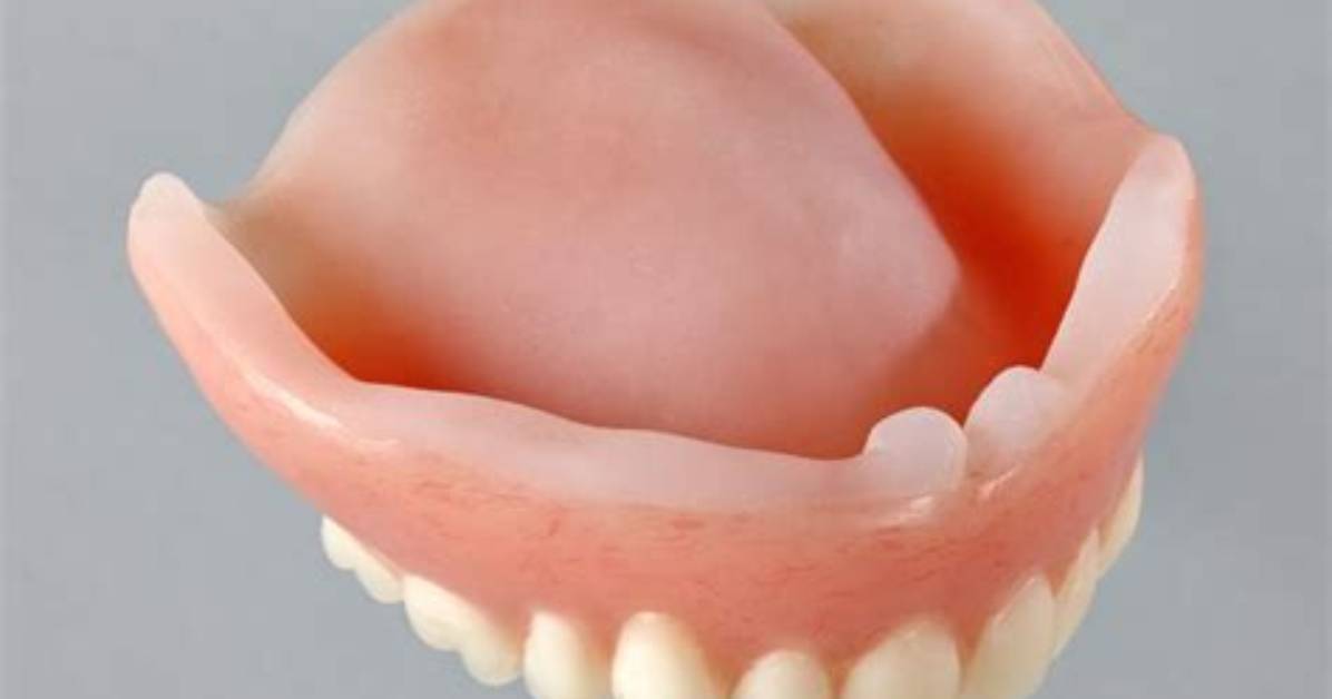 What Is a Permanent Soft Liner for Dentures?