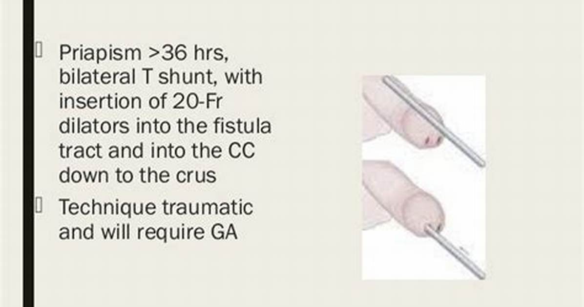 What Is a T Shunt for Priapism?