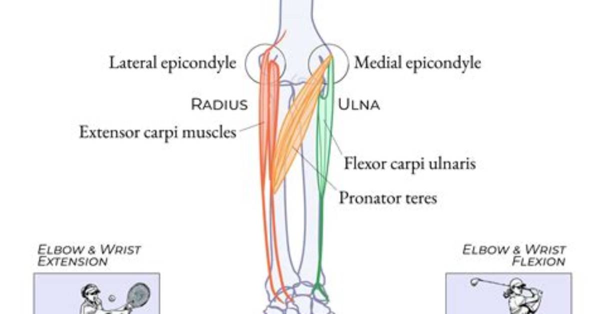What Is an Epicondyle - Lisbd-Net. Com