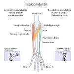 What Is an Epicondyle - Lisbd-Net. Com