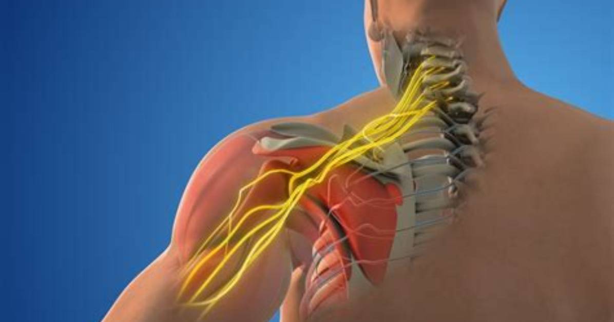 What Is an Injury Called a Stinger?