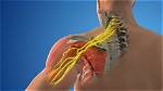 What Is an Injury Called a Stinger?