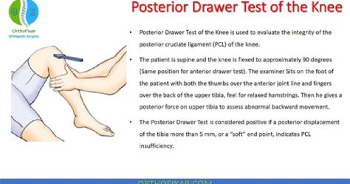 What Is Anterior and Posterior Drawer Test?
