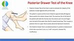 What Is Anterior and Posterior Drawer Test?