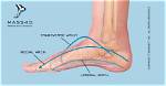 What Is Arch of Foot Called?