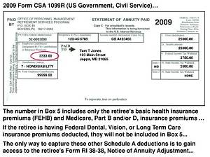 What Is Box 9B on Csa 1099R?