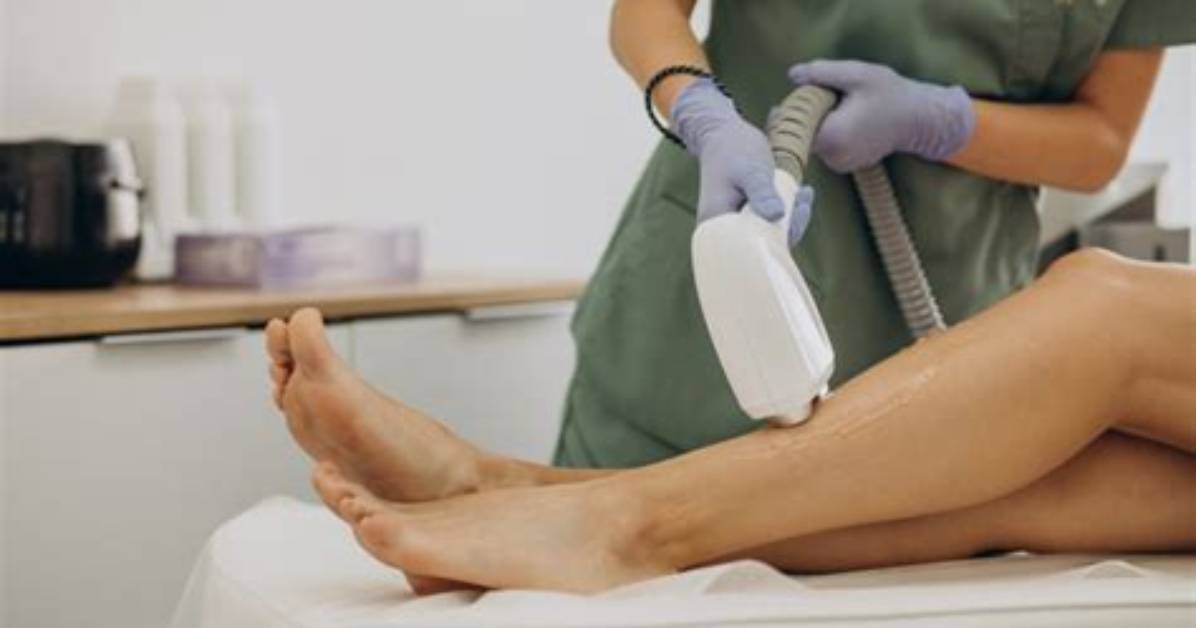 What Is Diode Laser Hair Removal?