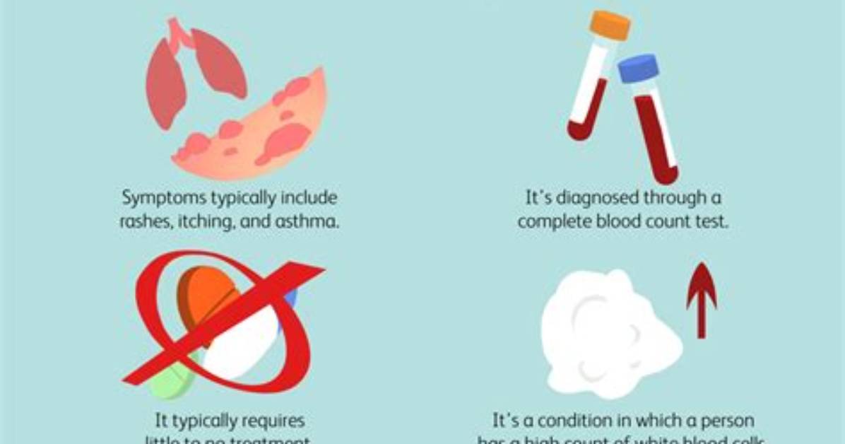 What Is Eosinophilia-Myalgia Syndrome (Ems)?
