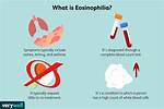 What Is Eosinophilia-Myalgia Syndrome (Ems)?