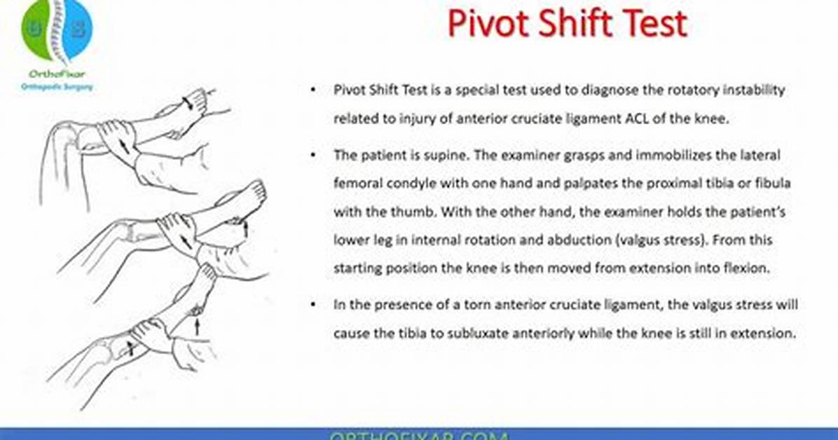 What Is Pivot Shift Test?