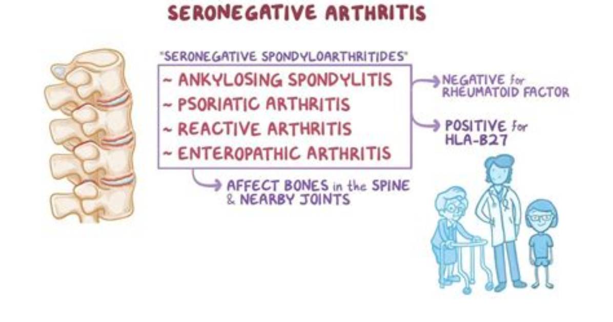What Is Seronegative Arthritides?