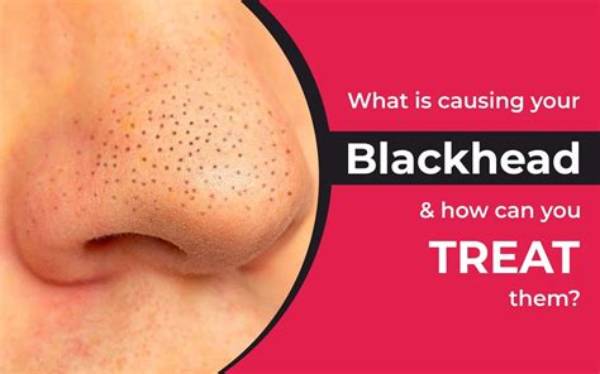 What Is the Black in a Blackhead?