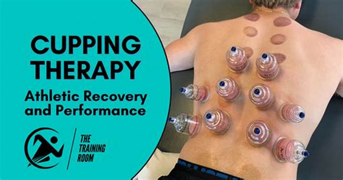 What Is the Cost of Cupping Therapy?