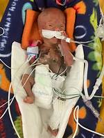 What Is the Earliest a Baby Has Ever Walked?