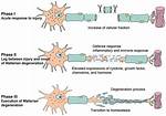 What Is the First Step in Wallerian Degeneration?