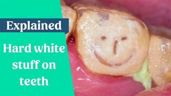 What Is the Hard White Stuff on My Teeth?
