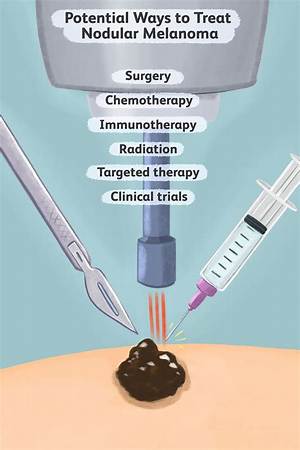 What Is the Newest Treatment for Melanoma?