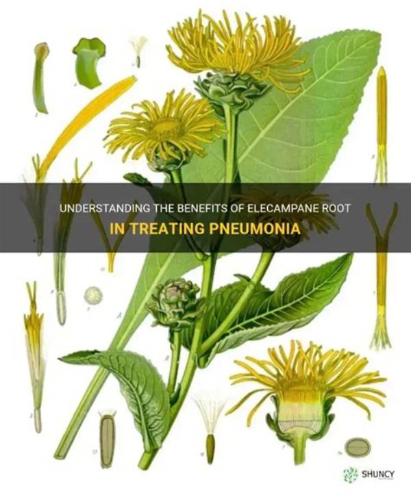 What Is the Root of Pneumonia?
