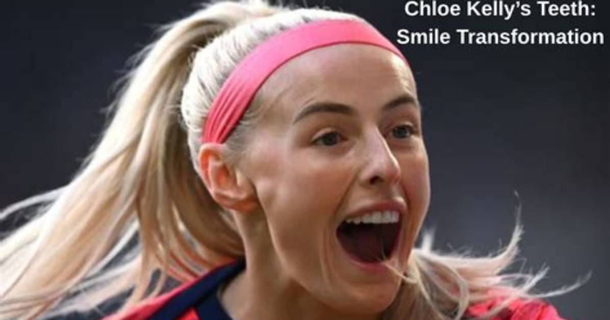 What Is Wrong with Chloe Kelly Teeth? Face and Nose Injury – Does She Use Braces?