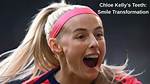 What Is Wrong with Chloe Kelly Teeth? Face and Nose Injury – Does She Use Braces?