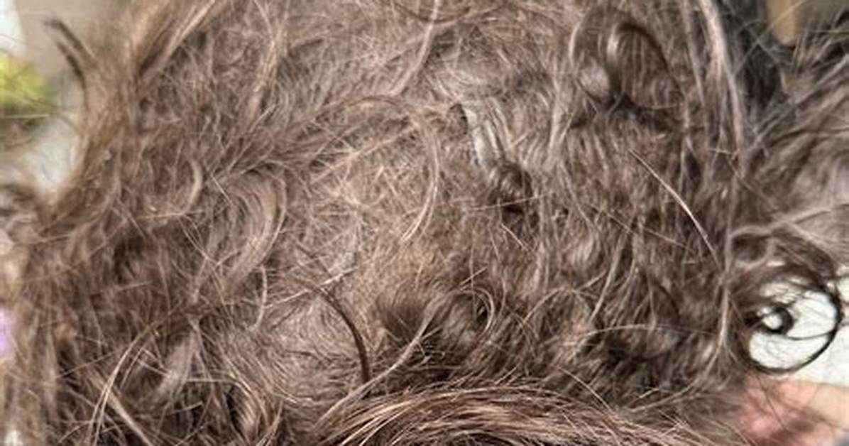 What Loosens Matted Hair?
