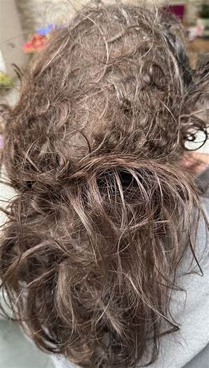 What Loosens Matted Hair?