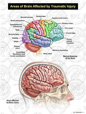 What Part of the Brain Is Affected by Epilepsy?
