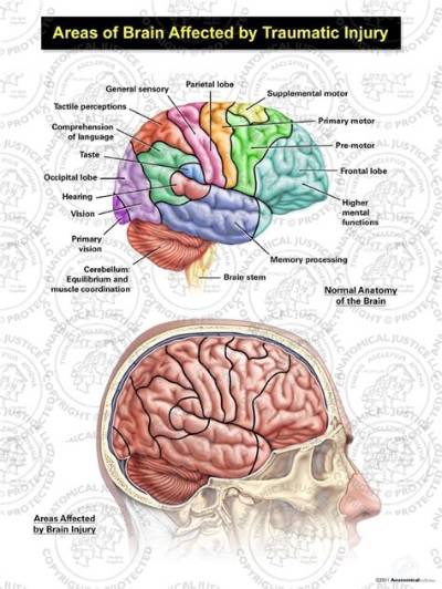 What Part of the Brain Is Affected by Epilepsy?