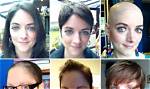 What Percentage of Chemo Patients Lose Their Hair?