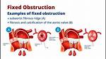 What's the Difference Between Obstruction and Interference?