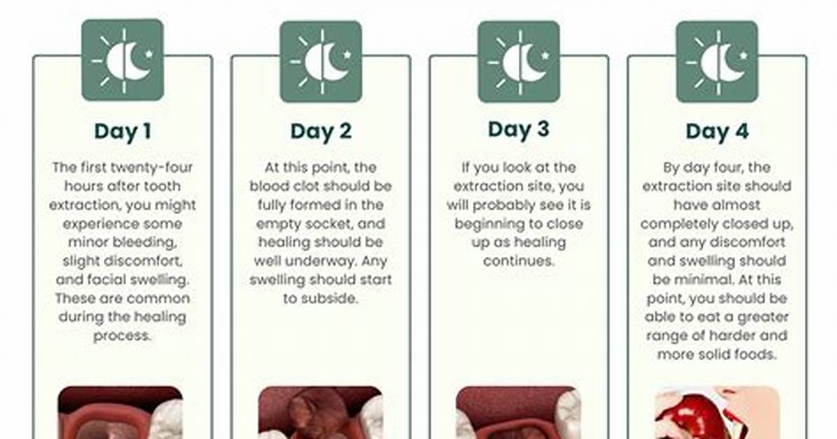 What Should I Do the Day After Pitching?