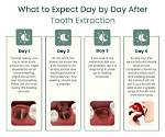 What Should I Do the Day After Pitching?