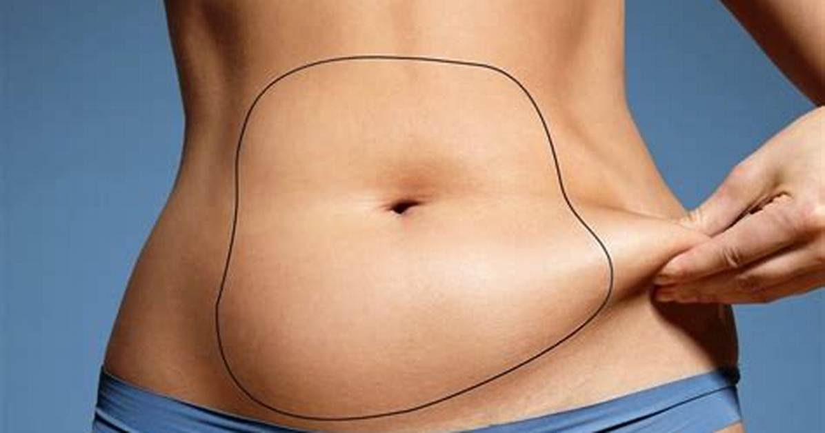 What Vitamins Should I Take Before Liposuction?