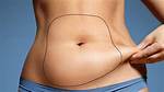 What Vitamins Should I Take Before Liposuction?