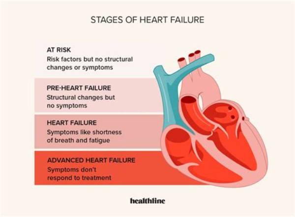What Were Your First Signs of Chf?
