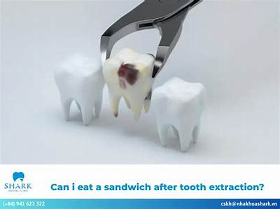 When Can I Eat a Cheeseburger After Tooth Extraction?