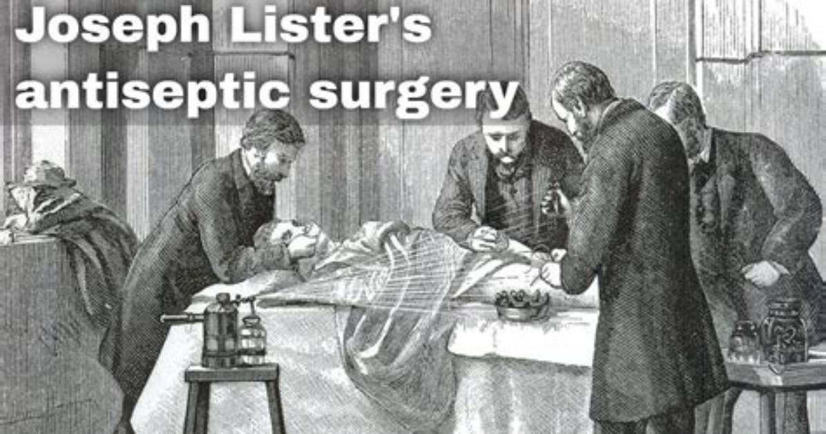 When Did Aseptic Surgery Start?