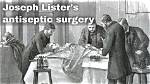 When Did Aseptic Surgery Start?