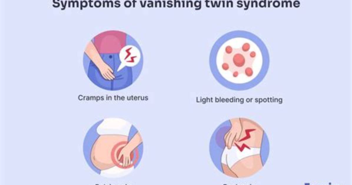 When Does Vanishing Twin Syndrome Usually Happen?