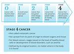 When Is Cancer Considered Terminal?