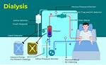 When to Dialyze a Patient?