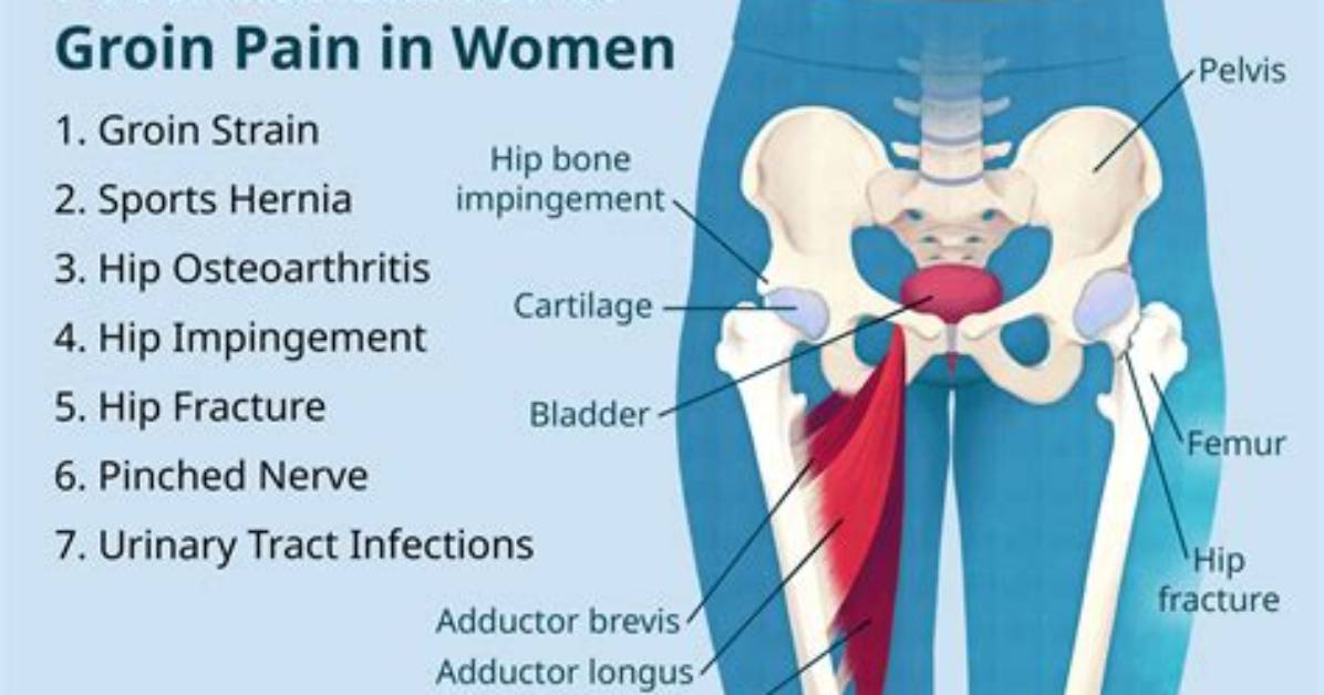 Where Does Groin Hurt?