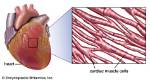 Where Is Cardiac Muscle Found?