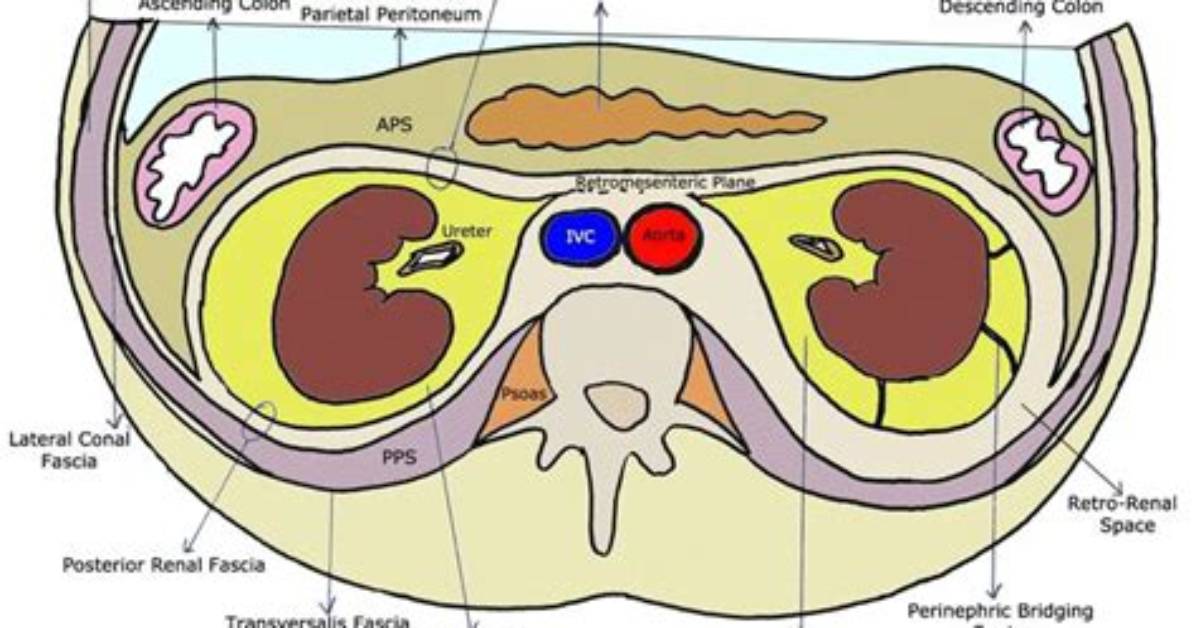 Where Is Perinephric Fluid Found?