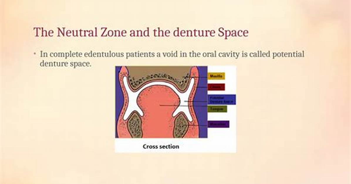 Where Is the Neutral Zone