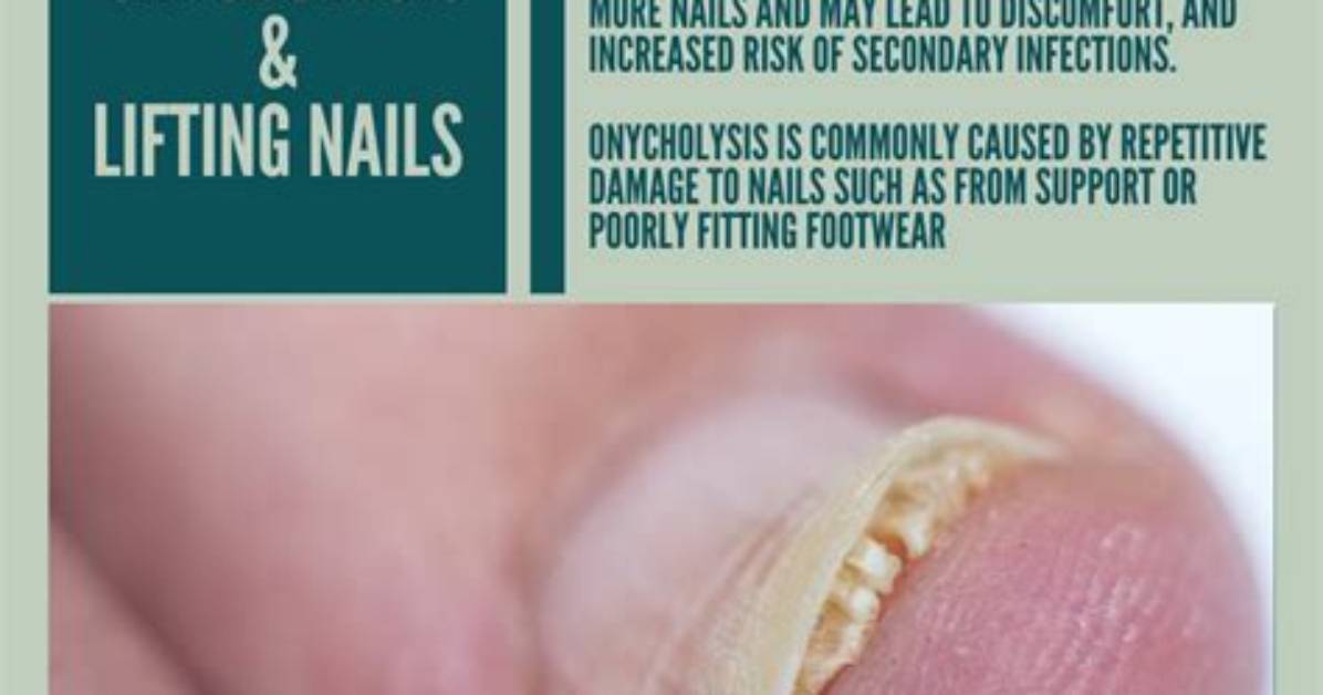 Which Drugs Cause Onycholysis?