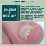Which Drugs Cause Onycholysis?